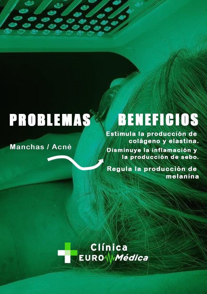 Tratamientos de acné SPA